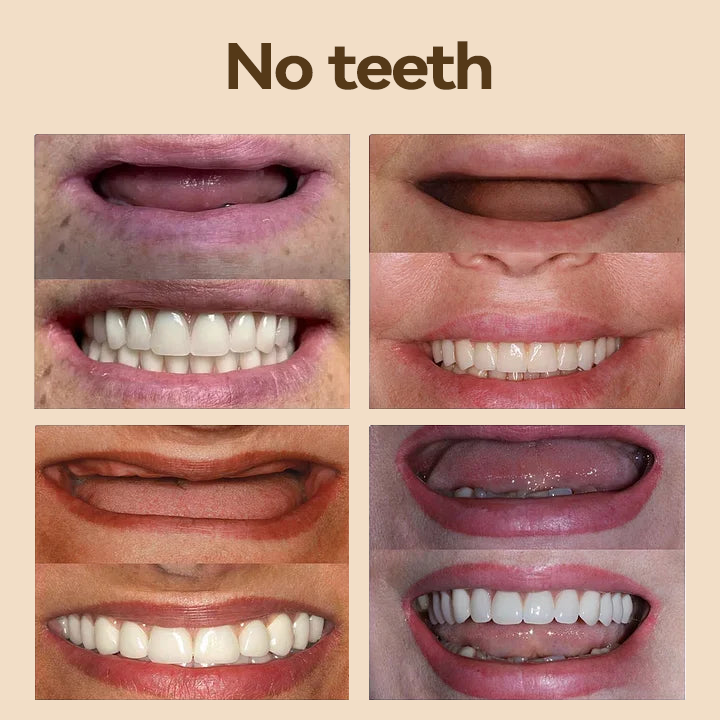 𝐇𝐢𝐝𝐨𝐧𝐞® 🐼🐼- 𝐏𝐫𝐞𝐦𝐢𝐮𝐦 𝐃𝐞𝐧𝐭𝐮𝐫𝐞- (✨Suitable for all mouth shapes, custom-made dentures for a perfect fit✨）