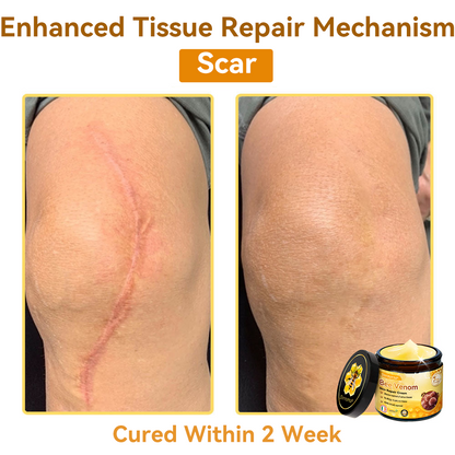 (🚚Made and shipped from Ireland✅) 𝐃𝐨𝐫𝐦𝐨𝐫𝐧𝐚®🍀Bee Venom Skin Repair Cream- LAST DAY 70% OFF