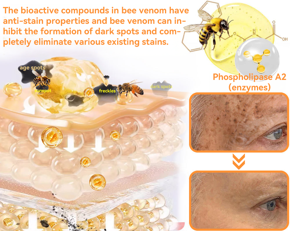 🔴𝐃𝐨𝐫𝐦𝐨𝐫𝐧𝐚™ 𝐀𝐥𝐥-𝐁𝐨𝐝𝐲 𝐒𝐤𝐢𝐧 𝐓𝐫𝐞𝐚𝐭𝐦𝐞𝐧𝐭 𝐂𝐫𝐞𝐚𝐦 Bee venom cream for all types of fungal wrinkles and scars all over the body.