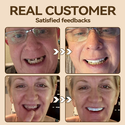 𝐇𝐢𝐝𝐨𝐧𝐞® 🐼🐼- 𝐏𝐫𝐞𝐦𝐢𝐮𝐦 𝐃𝐞𝐧𝐭𝐮𝐫𝐞- (✨Suitable for all mouth shapes, custom-made dentures for a perfect fit✨）
