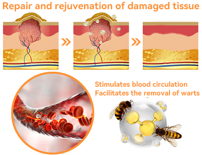 🔴𝐃𝐨𝐫𝐦𝐨𝐫𝐧𝐚™ 𝐀𝐥𝐥-𝐁𝐨𝐝𝐲 𝐒𝐤𝐢𝐧 𝐓𝐫𝐞𝐚𝐭𝐦𝐞𝐧𝐭 𝐂𝐫𝐞𝐚𝐦 Bee venom cream for all types of fungal wrinkles and scars all over the body.