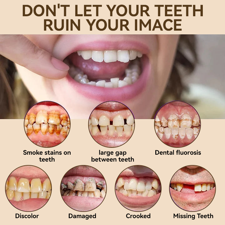 𝐇𝐢𝐝𝐨𝐧𝐞® 🐼🐼- 𝐏𝐫𝐞𝐦𝐢𝐮𝐦 𝐃𝐞𝐧𝐭𝐮𝐫𝐞- (✨Suitable for all mouth shapes, custom-made dentures for a perfect fit✨）