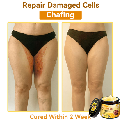 (🚚Made and shipped from Ireland✅) 𝐃𝐨𝐫𝐦𝐨𝐫𝐧𝐚®🍀Bee Venom Skin Repair Cream- LAST DAY 70% OFF