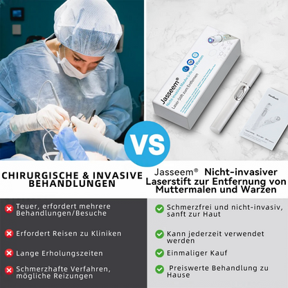 𝐉𝐚𝐬𝐬𝐞𝐞𝐦® medizinischä Laserpen 🚚🎁 (nutzt CO₂-Lasertechnologii – wirkungsvoll zum Entfernä vo Muttermalä, Warzä, Hautanhängslä, Pigmentfleckä und andere Hautunreinheite)