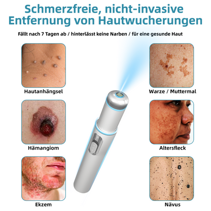 𝐉𝐚𝐬𝐬𝐞𝐞𝐦® medizinischä Laserpen 🚚🎁 (nutzt CO₂-Lasertechnologii – wirkungsvoll zum Entfernä vo Muttermalä, Warzä, Hautanhängslä, Pigmentfleckä und andere Hautunreinheite)