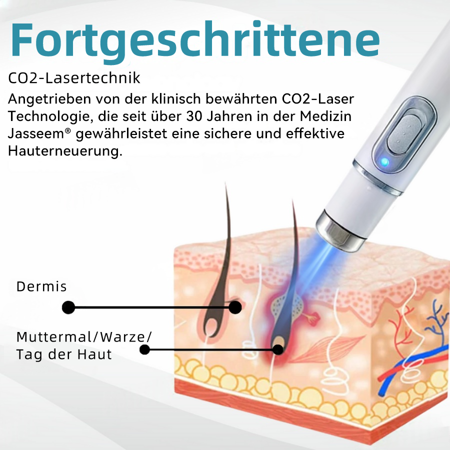 𝐉𝐚𝐬𝐬𝐞𝐞𝐦® medizinischä Laserpen 🚚🎁 (nutzt CO₂-Lasertechnologii – wirkungsvoll zum Entfernä vo Muttermalä, Warzä, Hautanhängslä, Pigmentfleckä und andere Hautunreinheite)